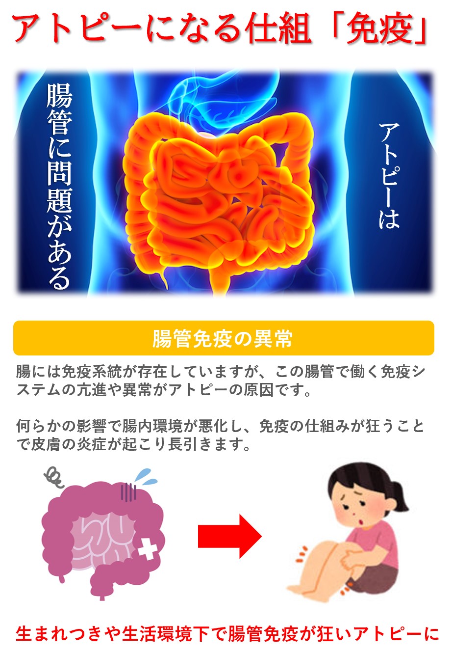 アトピーの原因：腸内環境悪化による免疫バランスの悪化